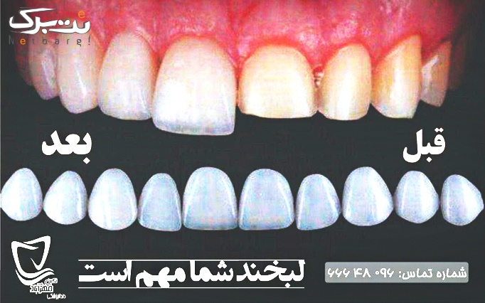 187b037e