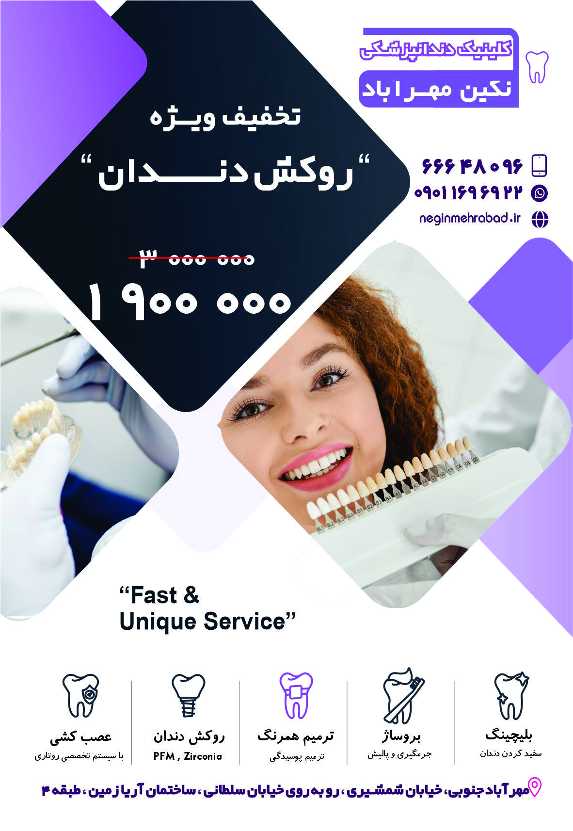 تخفیف 40 درصدی روکش دندان 1 n1